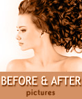 Before and after pictures