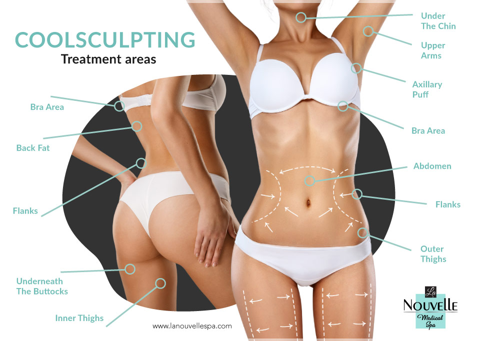 CoolSculpting for Fat Removal  La Nouvelle Medical Spa, Oxnard, Ventura