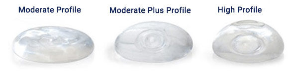 silicone-breast-implants-ventura-county-profiles-dr-hanna